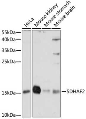 Western Blot: PGL2 Antibody [NBP2-94039] - Western blot analysis of extracts of various cell lines, using PGL2 antibody (NBP2-94039) at 1:1000 dilution. Secondary antibody: HRP Goat Anti-Rabbit IgG (H+L) at 1:10000 dilution. Lysates/proteins: 25ug per lane. Blocking buffer: 3% nonfat dry milk in TBST. Detection: ECL Basic Kit. Exposure time: 10s.